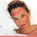 How Long Does a Vampire Facial Take?