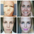 What is a Vampire Facial and How Can It Help Your Skin?