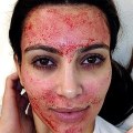 Why Kim Kardashian West Regrets Her Vampire Facial