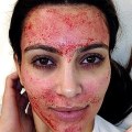 Why does kim kardashian regret vampire facial?