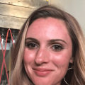 The Benefits of a Vampire Facial: Is it the Same as Microneedling?