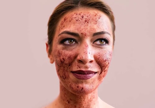 Does Vampire Facial Help Pigmentation? A Comprehensive Guide