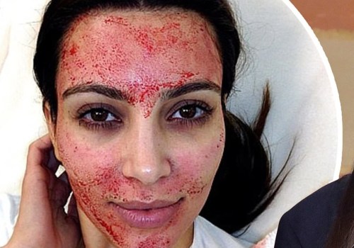 Why does kim kardashian regret vampire facial?