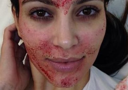 Where did kim kardashian get her vampire facial?